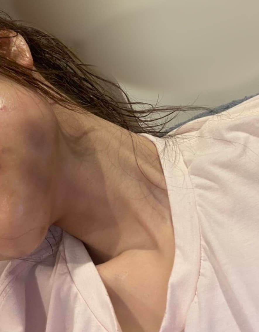 新宿歌舞伎町路上ホスト殺人未遂事件の経緯：女性はホストに1800万円を貢ぎDVを受けていた